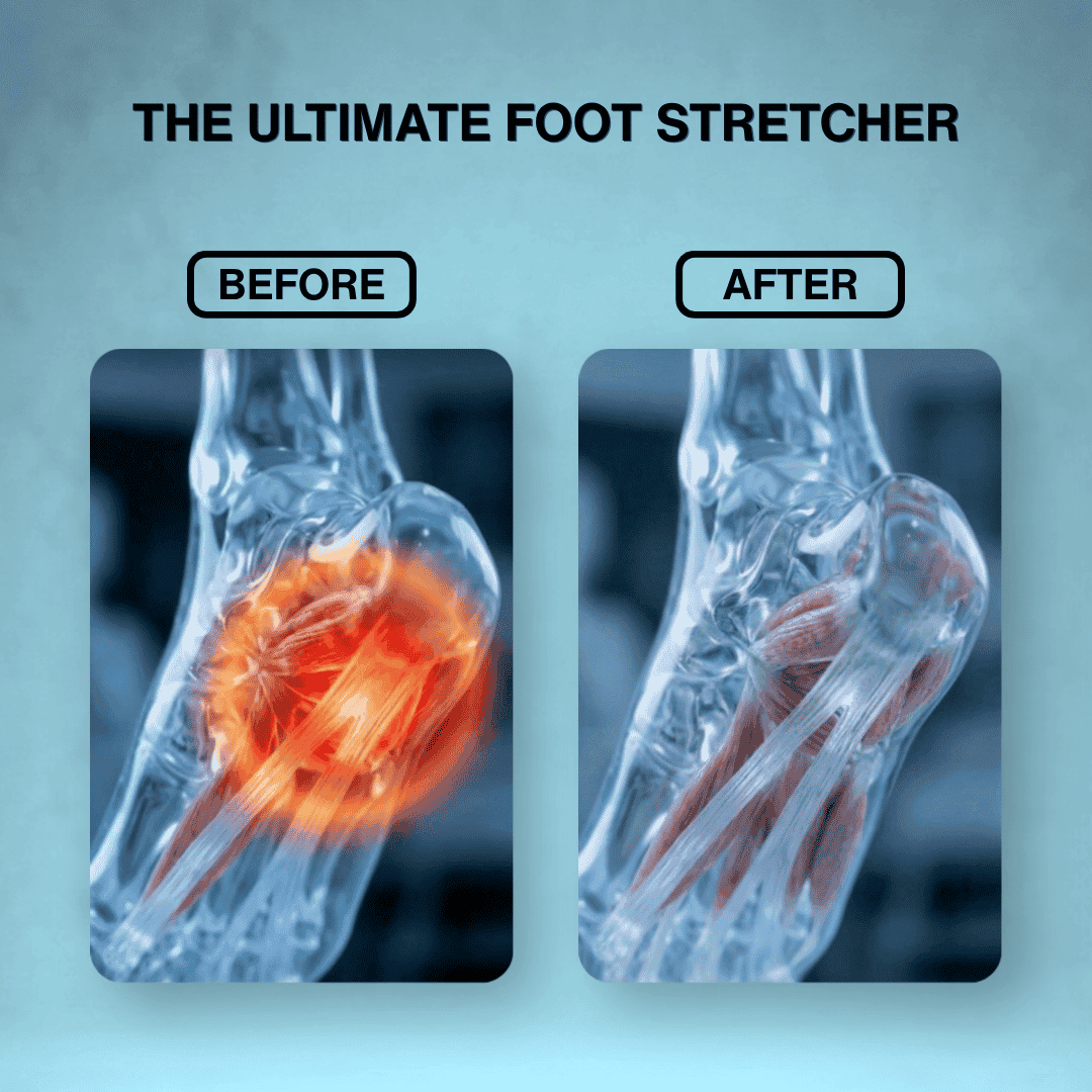 The Ultimate Foot Stretcher