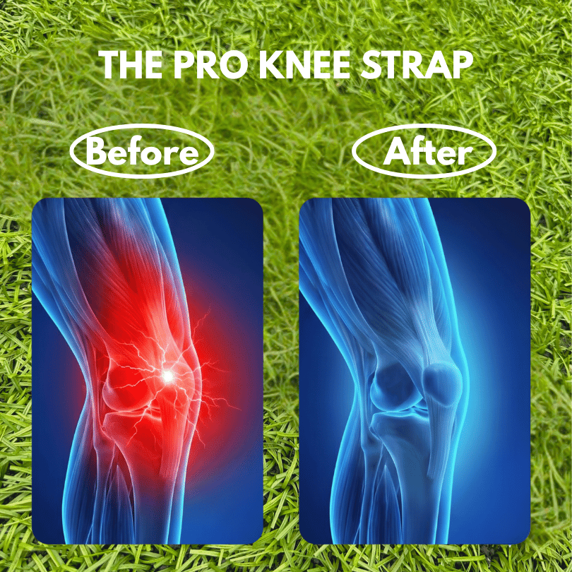The Pro Knee Strap
